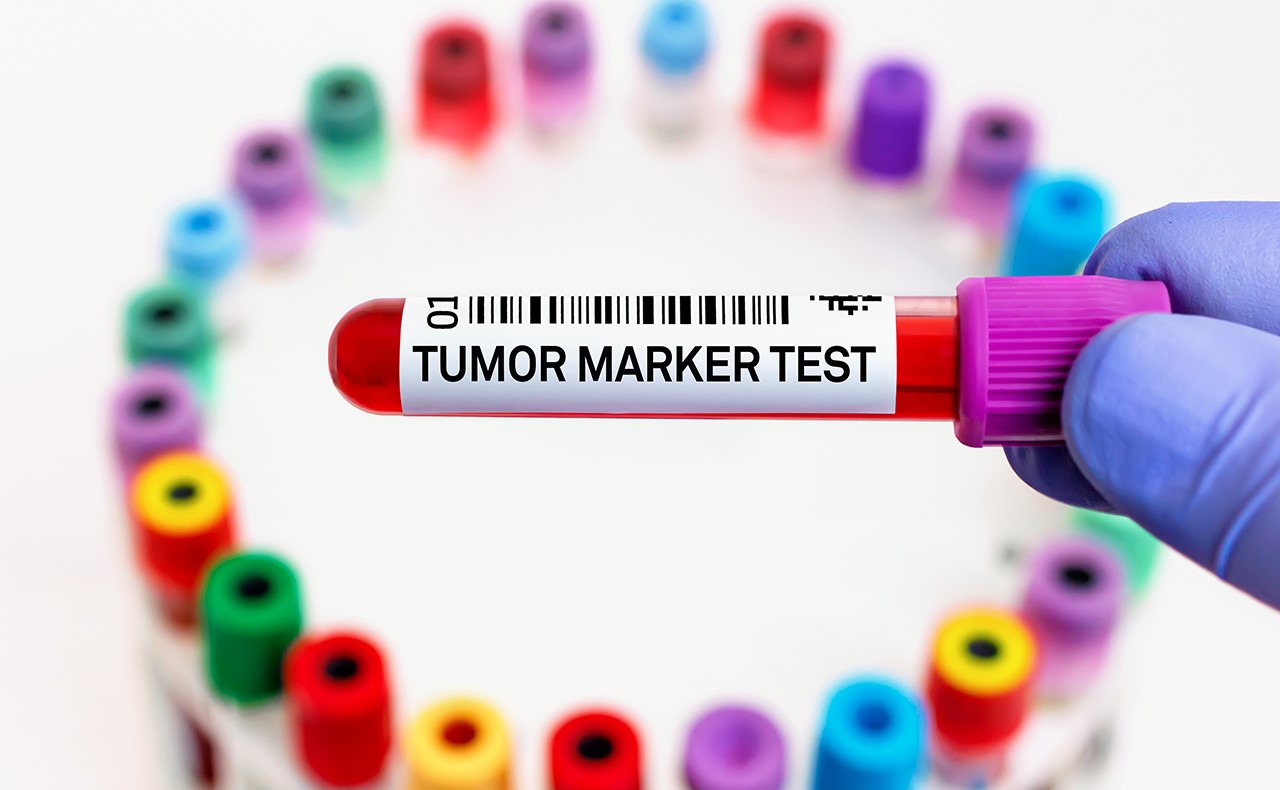 Cancer Biomarkers