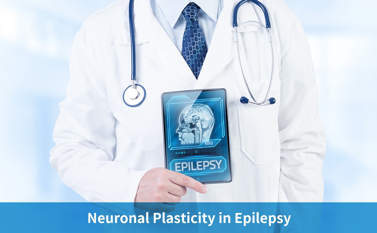 Neuronal Plasticity in Epilepsy
